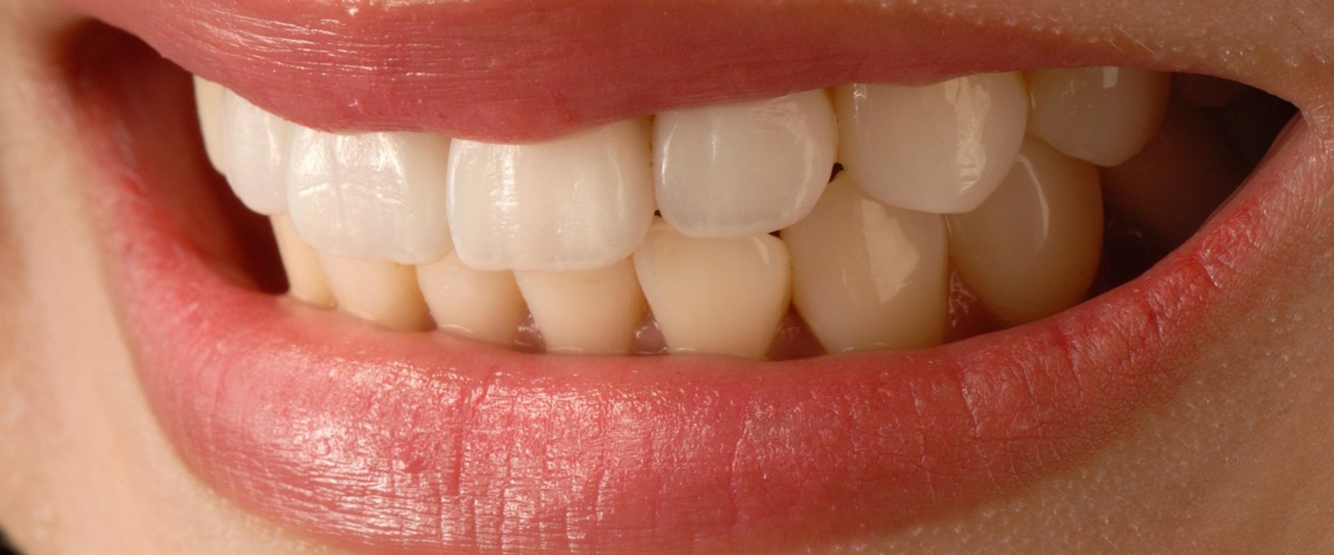 From Dental Veneers to Confident Smiles: Why Children Orthodontics Matters in New York