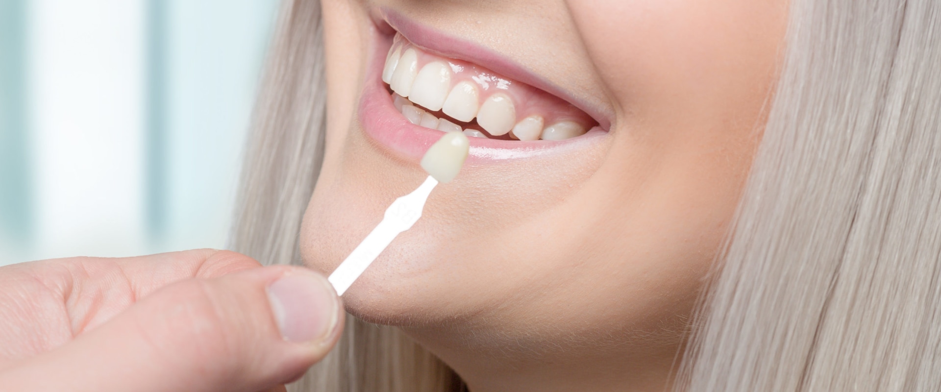 How often should veneers be replaced?