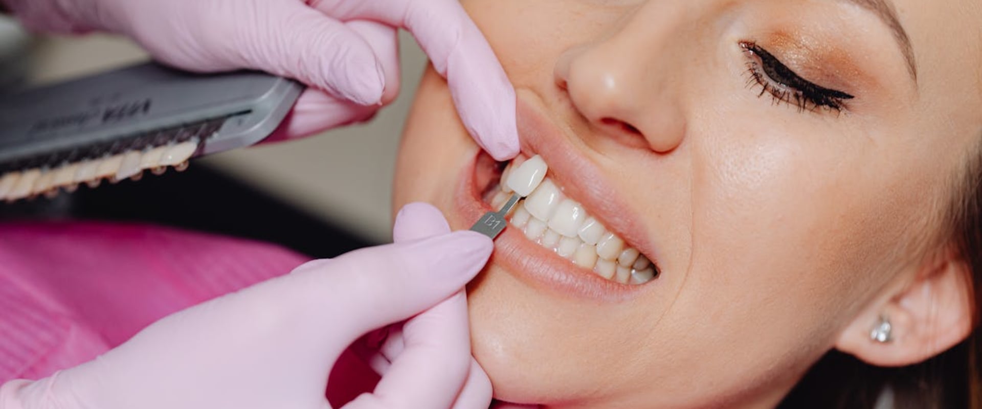 Transform Your Smile: The Magic Of Dental Veneers In Hamilton