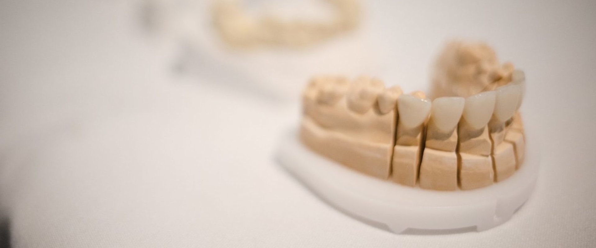 What are disadvantages of veneers?