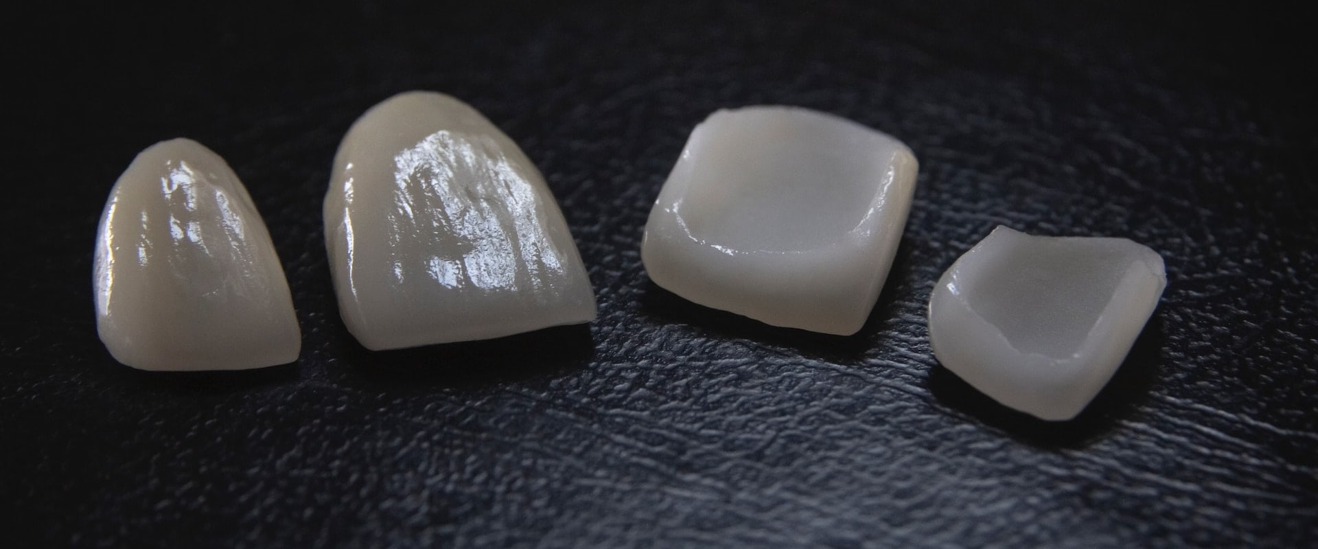 The Aesthetic Benefits Of Dental Veneers: Enhancing Your Facial Features In Boerne, TX