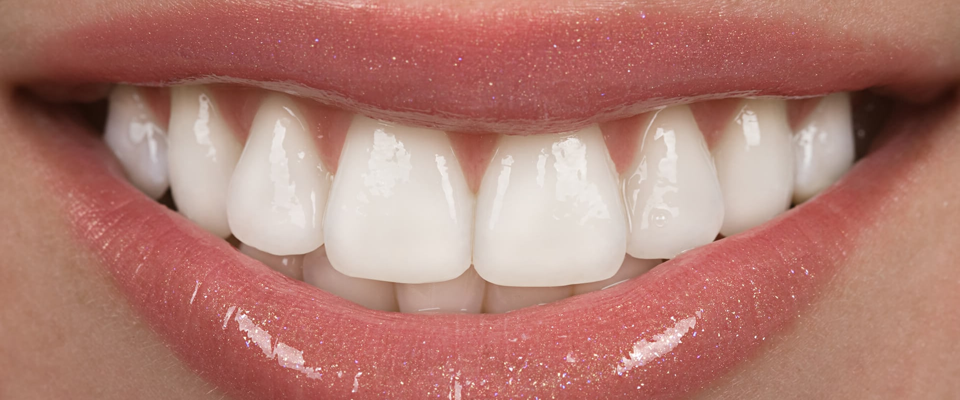 Dental Veneers In Spring, TX: A Guide To Transform Your Smile With Porcelain