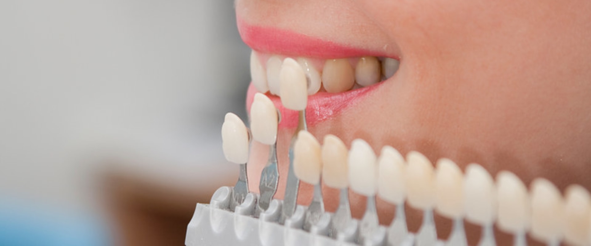Experience The Power Of Porcelain Veneers In Conroe: Unveiling A Beautiful Smile