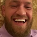 How To Get The Perfect Smile With Dental Veneers In McGregor
