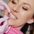 Transform Your Smile: The Magic Of Dental Veneers In Hamilton