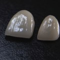 The Aesthetic Benefits Of Dental Veneers: Enhancing Your Facial Features In Boerne, TX