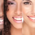 Exploring Different Types Of Dental Veneers In Taylor, TX