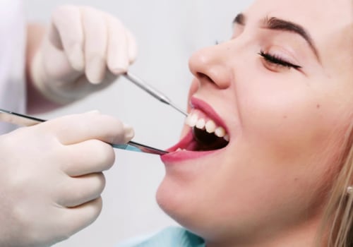 Smile Transformations: Discovering Dental Veneers In Gainesville, VA