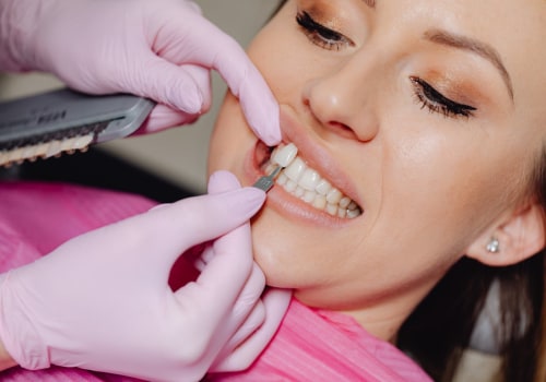 Transform Your Smile: The Magic Of Dental Veneers In Hamilton