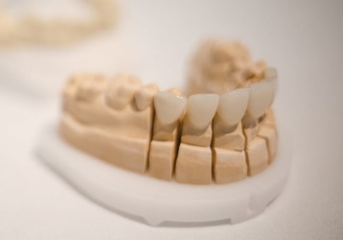 What are disadvantages of veneers?
