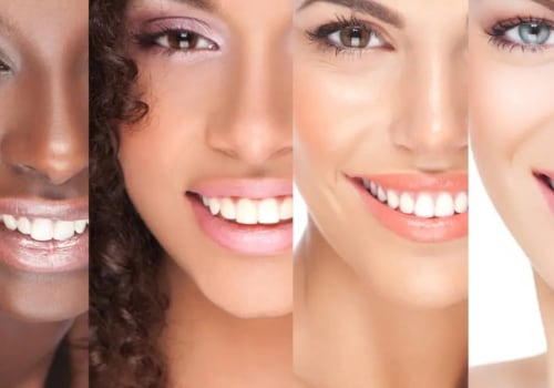 Exploring Different Types Of Dental Veneers In Taylor, TX
